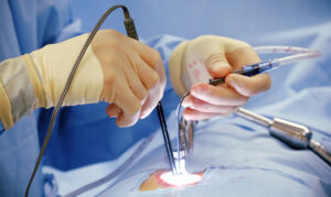 Minimally Invasive Spine Surgery – Microscopic and Endoscopic | Back pain Treatment Doctor Kolkata