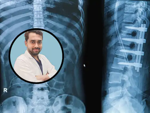 Best Spine Surgeon in Kolkata - Dr. Sai Viksheth Raj B